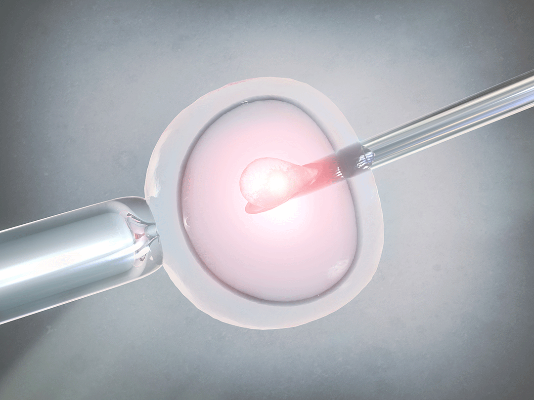 La F Condation In Vitro Gen Ve Gyneco